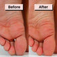 Pedicuure™: Automatic Callus Remover